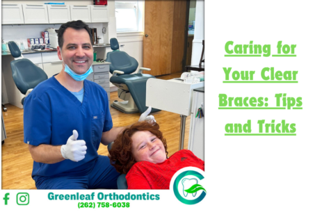 Caring for your clear braces: Tips and Tricks