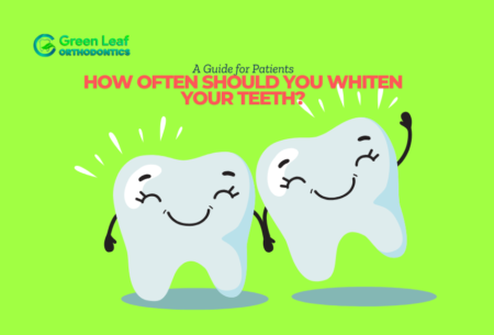 How Often Should You Whiten Your Teeth? A Guide for Patients